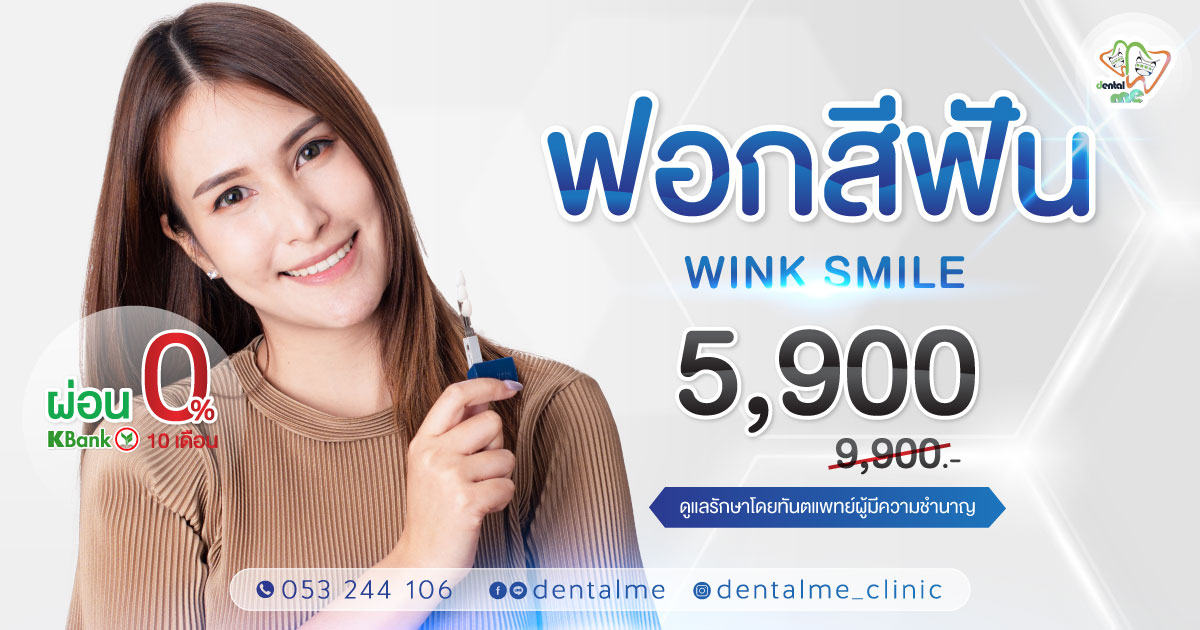 DM-wink-1200x630