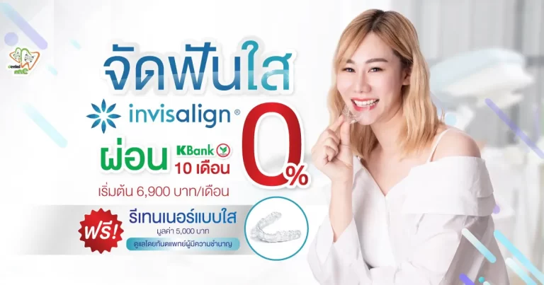 โปรโมชั่นจัดฟันใส Invisalign ที่เชียงใหม่ ผ่อน 0% 10 เดือน เริ่มต้น 6,900 บาท/เดือน ฟรีรีเทนเนอร์แบบใส โดย Dentalme Clinic