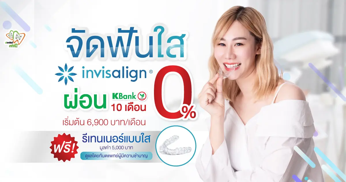 โปรโมชั่นจัดฟันใส Invisalign ที่เชียงใหม่ ผ่อน 0% 10 เดือน เริ่มต้น 6,900 บาท/เดือน ฟรีรีเทนเนอร์แบบใส โดย Dentalme Clinic