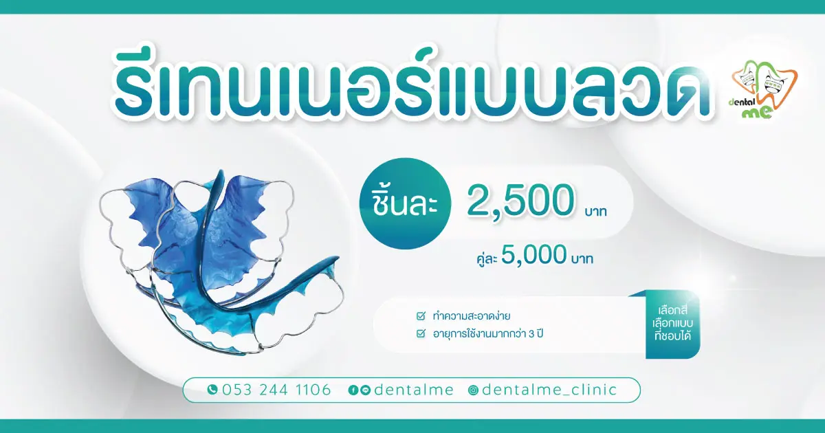 รีเทนเนอร์แบบลวด Dentalme Clinic เชียงใหม่ ราคา 2,500 บาทต่อชิ้น คู่ละ 5,000 บาท