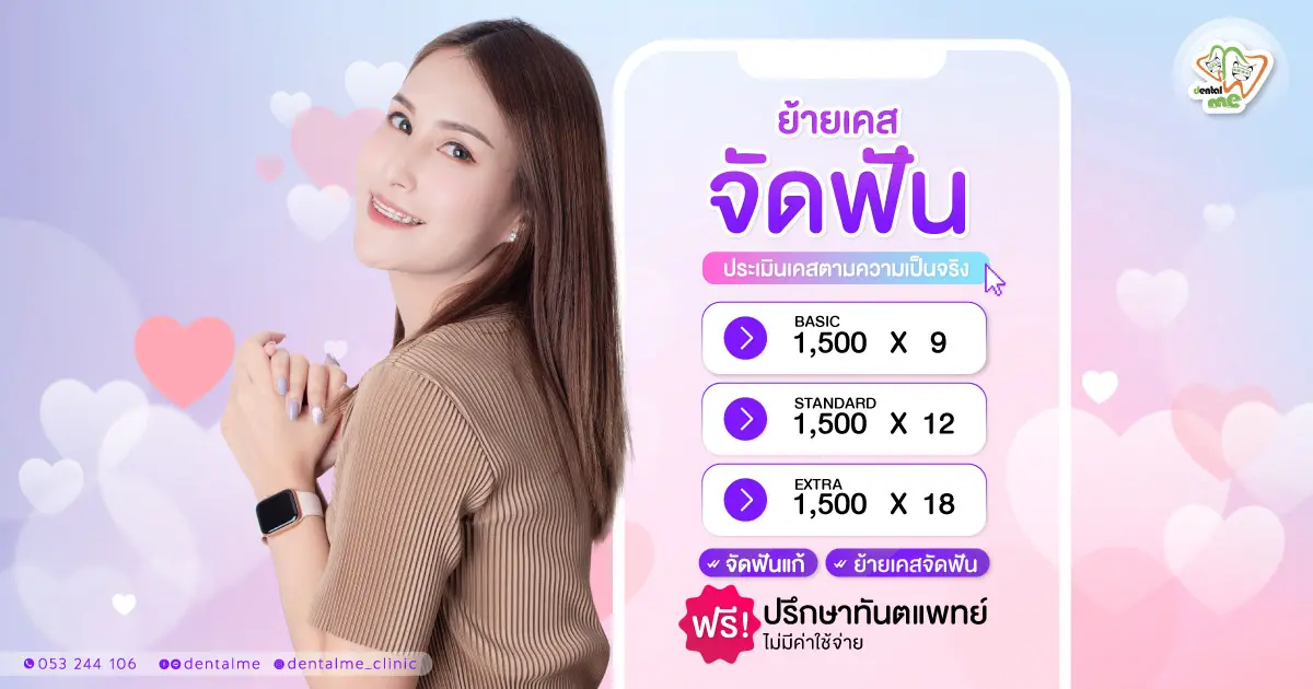 โปรโมชั่นย้ายเคสจัดฟัน Dentalme Clinic เชียงใหม่ จัดฟันต่อ ราคาพิเศษ พร้อมปรึกษาฟรี