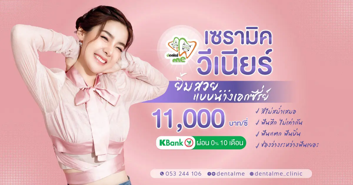 โปรโมชั่นวีเนียร์เชียงใหม่ ปกสไลด์ | Dentalme Clinic ทันตกรรมความงาม จัดฟัน Invisalign Veneer