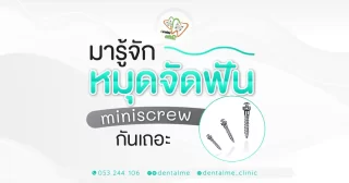 หมุดจัดฟัน Miniscrew คืออะไร – Dentalme Clinic เชียงใหม่