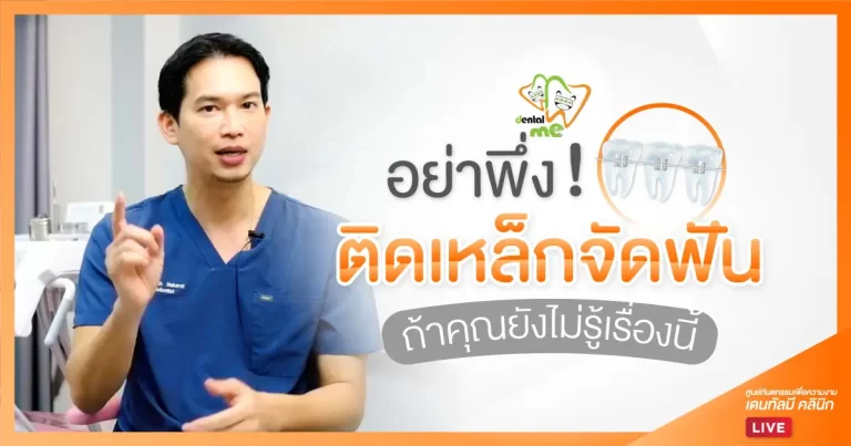 อย่าพึ่งติดเหล็กจัดฟัน ถ้ายังไม่รู้เรื่องนี้ – Dentalme Clinic เชียงใหม่