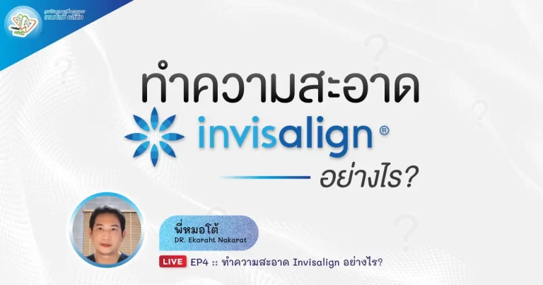 วิธีทำความสะอาด Invisalign – Dentalme Clinic เชียงใหม่