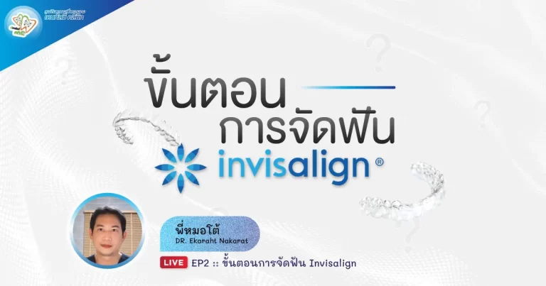 ขั้นตอนการจัดฟัน Invisalign – Dentalme Clinic เชียงใหม่