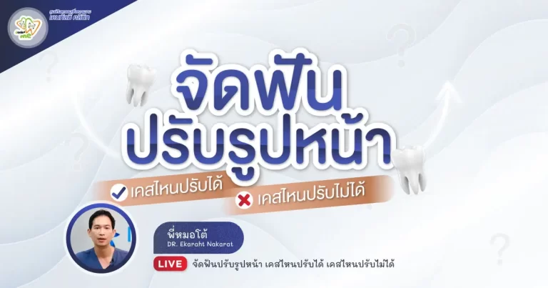 จัดฟันปรับรูปหน้า เคสไหนปรับได้ เคสไหนปรับไม่ได้ – Dentalme Clinic เชียงใหม่