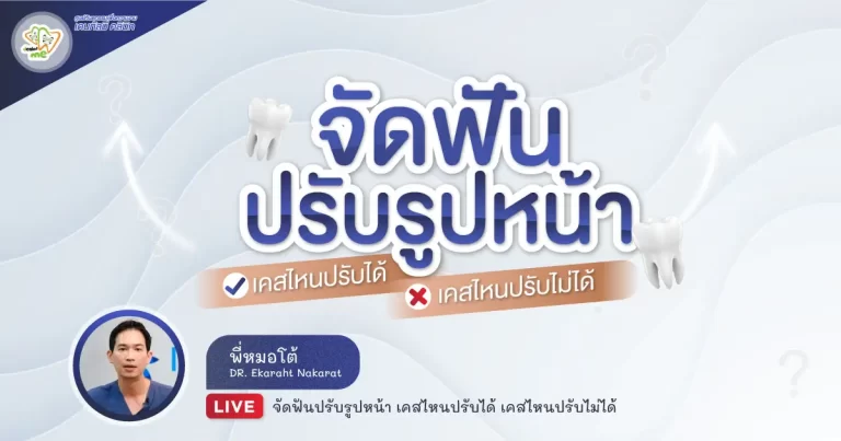 จัดฟันปรับรูปหน้า เคสไหนปรับได้ เคสไหนปรับไม่ได้ – Dentalme Clinic เชียงใหม่