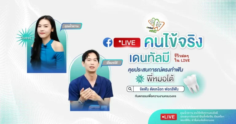 รีวิวสดจากคนไข้จริง – Dentalme Clinic เชียงใหม่