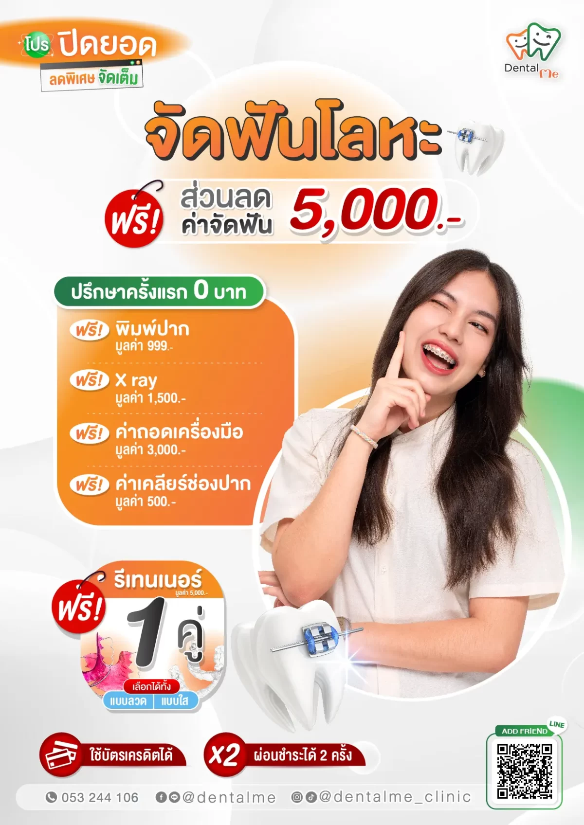 โปรโมชั่นจัดฟันโลหะ ปิดยอด ลดพิเศษ 5,000 บาท