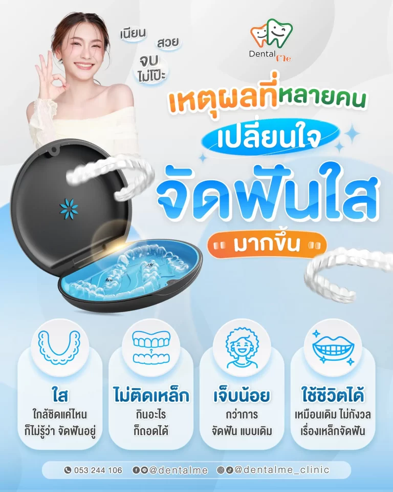 เหตุผลที่ควรเลือกจัดฟันใส Invisalign ที่เชียงใหม่ ใส ไม่ติดเหล็ก เจ็บน้อย ใช้ชีวิตได้ปกติ
