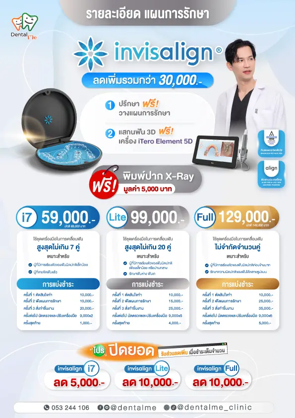 รายละเอียดแพ็กเกจจัดฟันใส Invisalign เชียงใหม่ ลดเพิ่มรวมกว่า 30,000 บาท ฟรีสแกนฟัน 3D