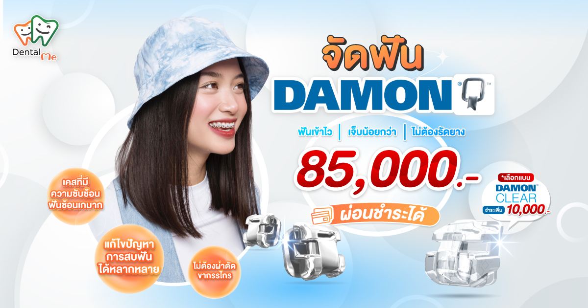 00DTM_BANNER_DAMON_WEB