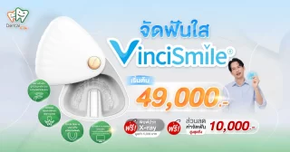 จัดฟันใส VinciSmile เชียงใหม่ เริ่มต้น 49,000 บาท ฟรีพิมพ์ปาก X-ray และส่วนลดค่าจัดฟัน