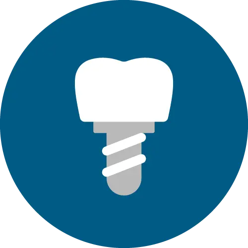 รากฟันเทียม Dental Implant เชียงใหม่ | Dentalme คลินิกทันตกรรม