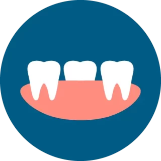 แก้ยิ้มเห็นเหงือก Gummy Smile เชียงใหม่ | Dentalme คลินิกทันตกรรม