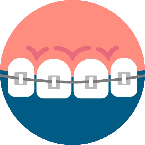 จัดฟัน เชียงใหม่ | Dentalme คลินิกทันตกรรม