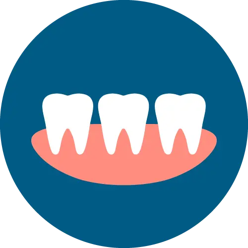 อุดฟัน เชียงใหม่ | Dentalme คลินิกทันตกรรม
